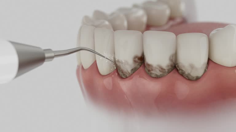 Trusted Emergency Dentist service in Bethesda, MD - Dentist Open Now
